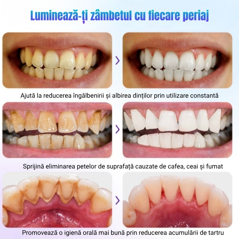 IKZEE – Pudră naturală pentru albirea dinților | Mentă & Lavandă | 35 gr - imagine 6