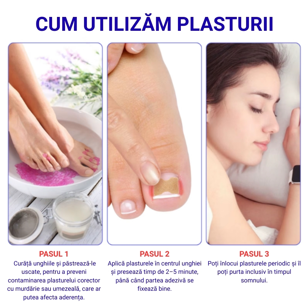 Set 100 Plasturi Corectori SEFUDUN® pentru Unghii Încarnate | Îngrijire profesională pentru unghii dureroase - imagine 9