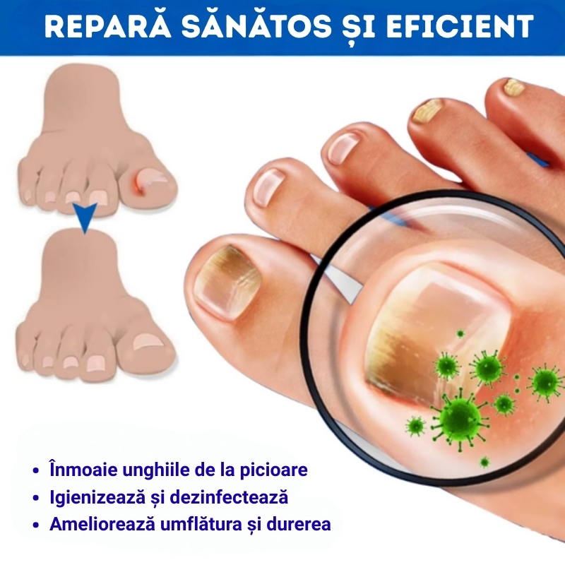 Ulei Tratament Unghii Încarnate și Anti-Paronichie SEFUDUN®– Dezinfectează, Ameliorează Durerea, Înmoaie și Reface Unghia Natural, 30ml - imagine 9