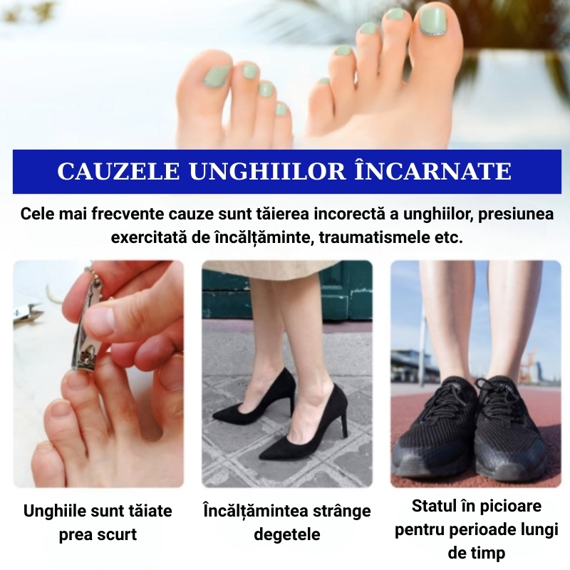 Ulei Tratament Unghii Încarnate și Anti-Paronichie SEFUDUN®– Dezinfectează, Ameliorează Durerea, Înmoaie și Reface Unghia Natural, 30ml - imagine 10