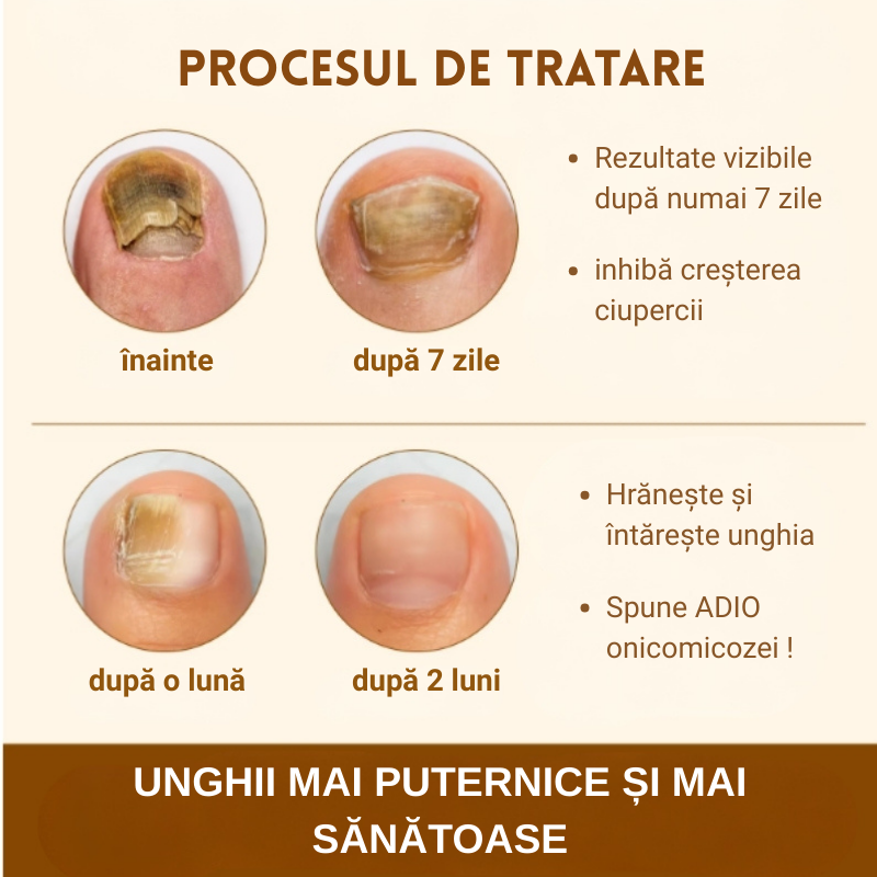 Ser natural SEFUDUN® pentru tratarea ciupercii unghiei, decolorării și fragilității, 60 ml - imagine 8