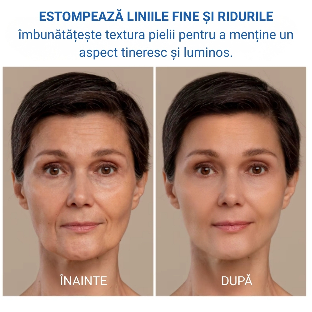 Ser facial Anti‑Îmbătrânire cu Colagen, Acid Hialuronic și Vitamina C – Fermitate, Hidratare și Luminozitate, 30 ml, SEFUDUN® - imagine 3