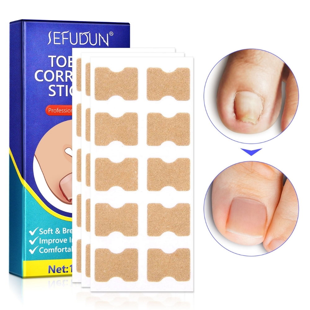 Set 100 Plasturi Corectori SEFUDUN® pentru Unghii Încarnate | Îngrijire profesională pentru unghii dureroase - imagine 10