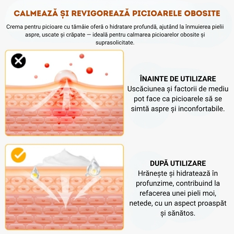 Cremă cu Tămâie pentru picioare și corp – Hidratare profundă 72H, pentru piele uscată, crăpată și obosită | 150g, YECUCE® - imagine 7