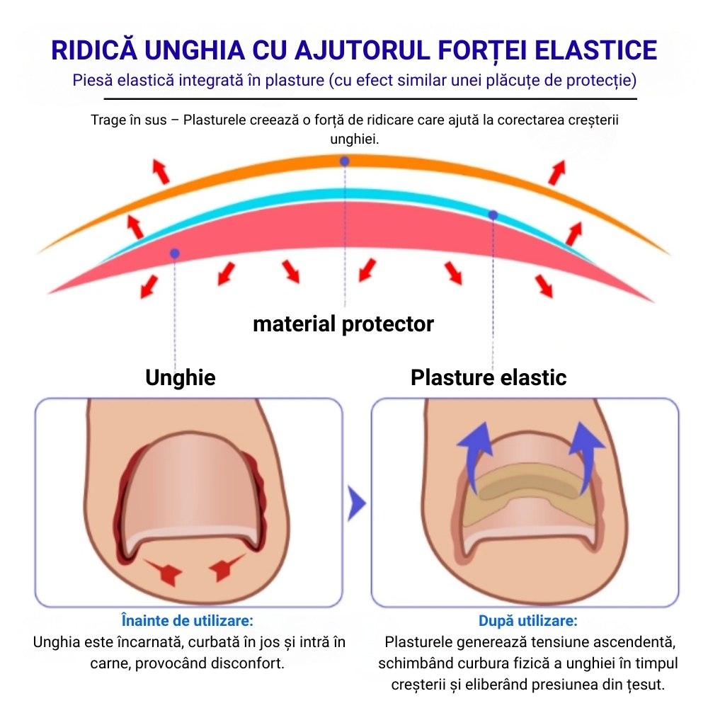 Set 100 Plasturi Corectori SEFUDUN® pentru Unghii Încarnate | Îngrijire profesională pentru unghii dureroase - imagine 7