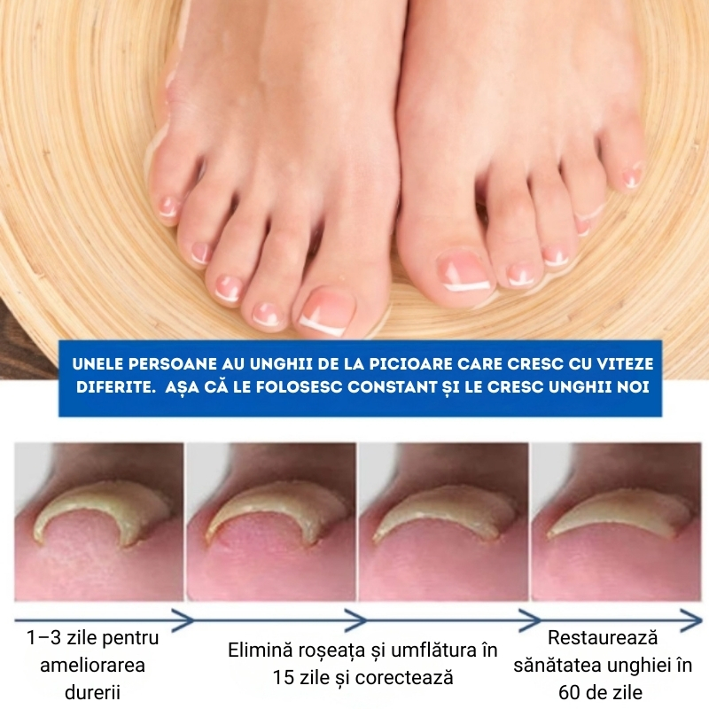 Ulei Tratament Unghii Încarnate și Anti-Paronichie SEFUDUN®– Dezinfectează, Ameliorează Durerea, Înmoaie și Reface Unghia Natural, 30ml - imagine 7
