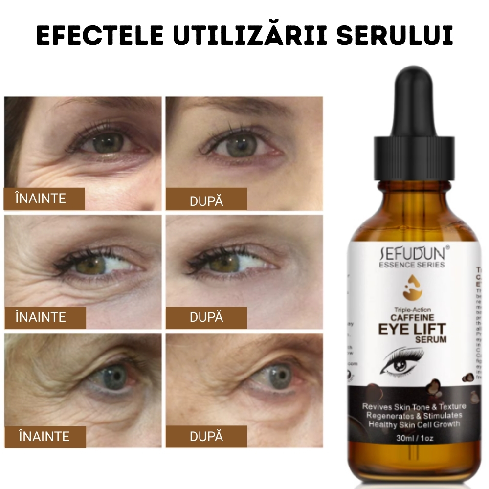 Ser facial cu Cafeină Eye Lift – Anti‑îmbătrânire, Fără Cearcăne și Pungi, Ingrediente 100% Organice, 30 ml, SEFUDUN® - imagine 8