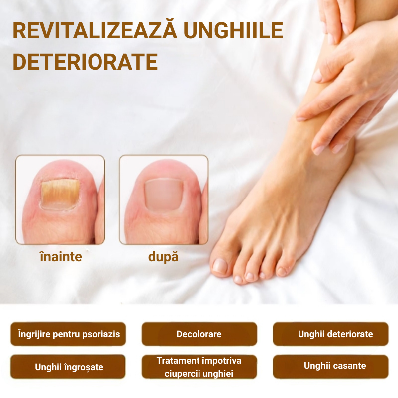 Ser natural SEFUDUN® pentru tratarea ciupercii unghiei, decolorării și fragilității, 60 ml - imagine 5