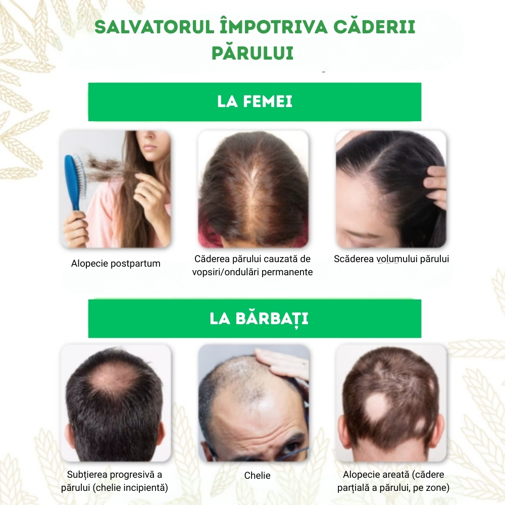 Spray cu apă de orez fermentată, Extract de Garofiță, Ulei de Ricin, Ghimbir și Vitamina B7, pentru Creșterea părului, fortifiere și hidratare naturală, 50 ml - imagine 9