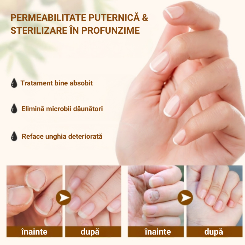 Ser natural SEFUDUN® pentru tratarea ciupercii unghiei, decolorării și fragilității, 60 ml - imagine 6