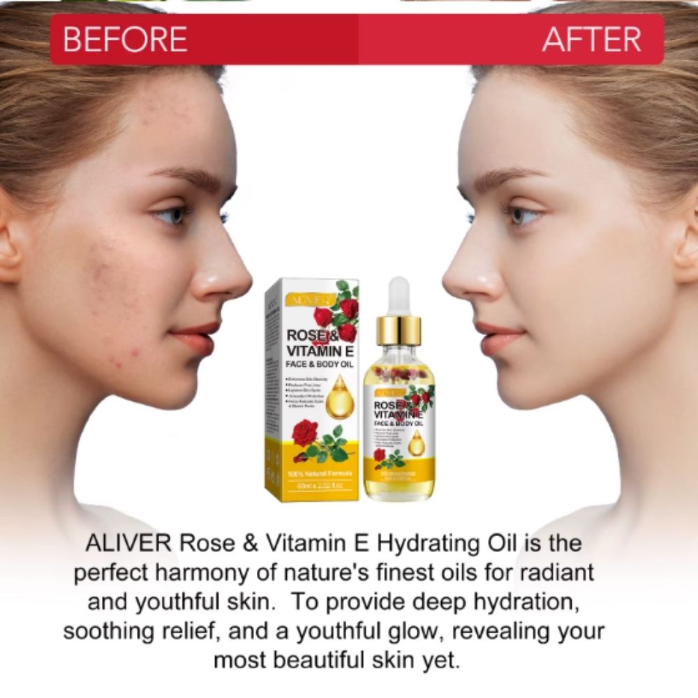 Ulei de Trandafir îmbogățit cu Bergamotă și Vitamina E pentru Față și Corp, ALIVER®, 60 ml - imagine 7