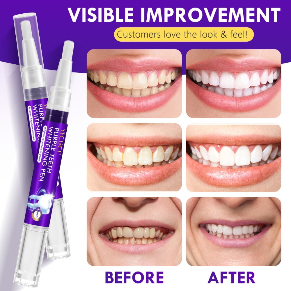 Kit profesional pentru albirea instantă a dinților, 6 stilouri corectoare de culoare violet, fără peroxid, YECUCE® - imagine 4