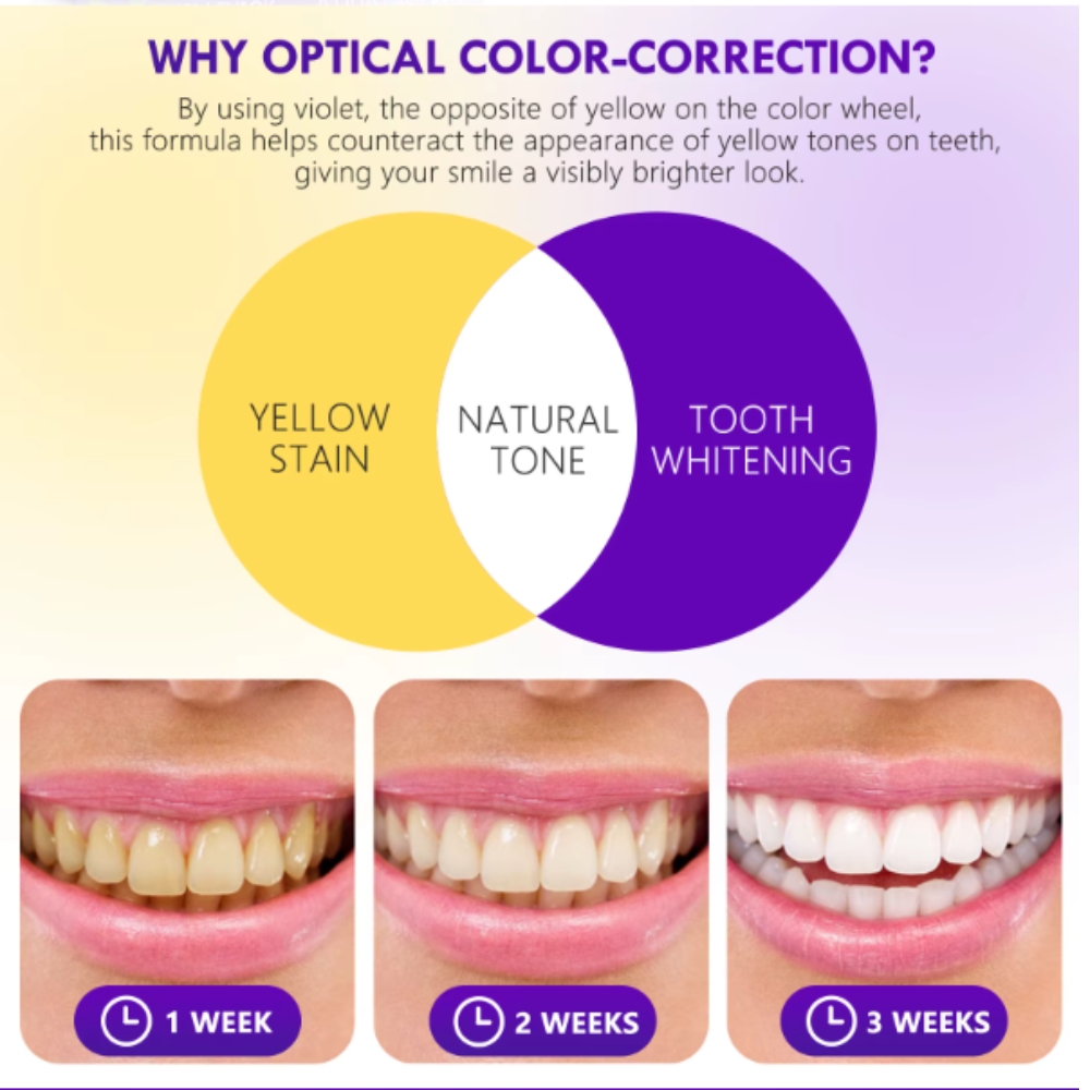 Kit profesional pentru albirea instantă a dinților, 6 stilouri corectoare de culoare violet, fără peroxid, YECUCE® - imagine 5