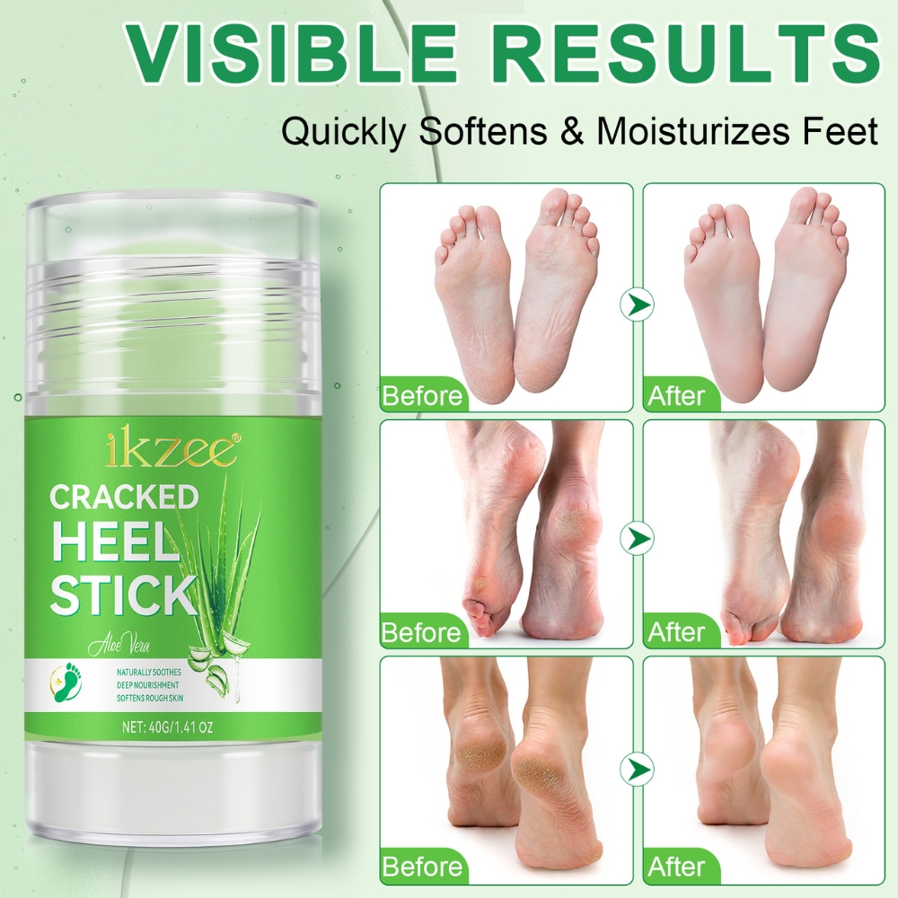 Balsam reparator tip stick cu Aloe vera pentru călcâie, mâini și coate crăpate, hidratare intensă & regenerare, 40 g, IKZEE® - imagine 3