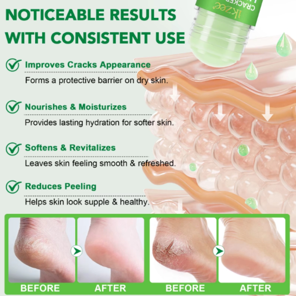 Balsam reparator tip stick cu Aloe vera pentru călcâie, mâini și coate crăpate, hidratare intensă & regenerare, 40 g, IKZEE® - imagine 8